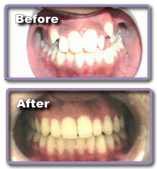This Set